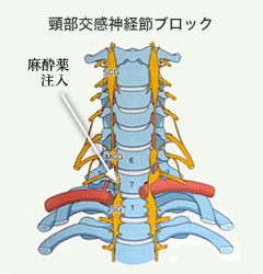 頚部交感神経節