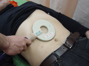 腹腔神経叢への照射例