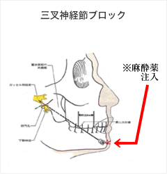 三叉神経