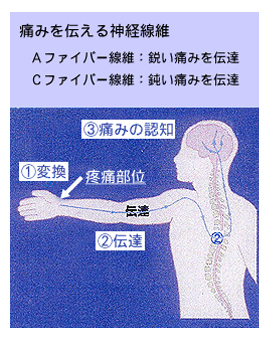 疼痛伝達の仕組み
