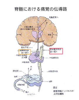 疼痛伝達の仕組み